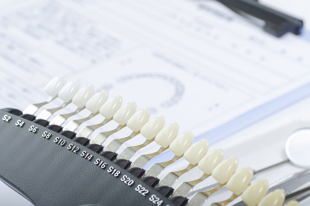 ホワイトニングとは